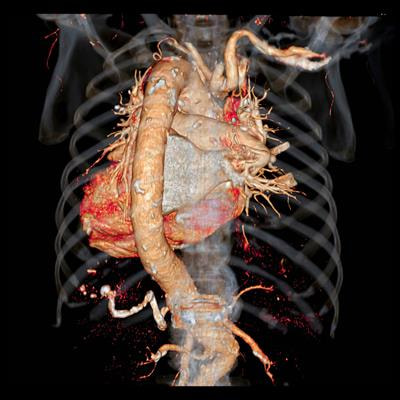 Cover image for research topic "Comprehensive Risk Prediction in Cardiomyopathies: New genetic and imaging markers of risk, Volume II"