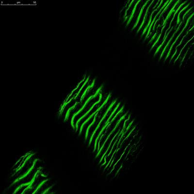 Cover image for research topic "Novel and Potential Biomarkers for Prediction of Outcome in Patients with Chronic and Acute Coronary Heart Disease, Volume II"