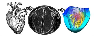 Cover image for research topic "Ventricular Mechanics in Congenital Heart Disease"