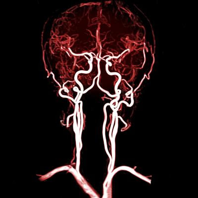 Cover image for research topic "Neurosonology in Stroke Medicine and Neurocritical care"
