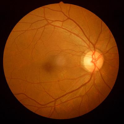 Cover image for research topic "Retinal metabolism in health and disease"