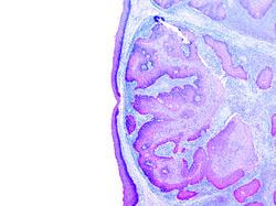 Cover image for research topic "Prognosis and Diagnosis of Hepatocellular Carcinoma"