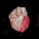 Cover image for research topic "Case Reports in Coronary Artery Disease: 2023"