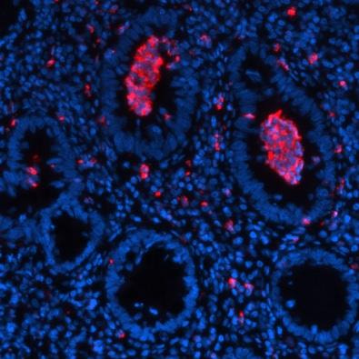 Cover image for research topic "Immune-epithelial Crosstalk in Inflammatory Bowel Diseases and Mucosal Wound Healing"