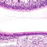 Cover image for research topic "Understanding and Treating Rare Nasal and Paranasal Sinus Cancers"