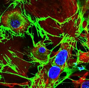 Cover image for research topic "Molecular Mechanisms and New Therapeutic Targets in Epithelial to Mesenchymal Transition (EMT) and Fibrosis"