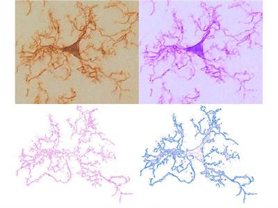 Cover image for research topic "Microglia in Neurodegenerative Disorders: in Sickness and in Health"