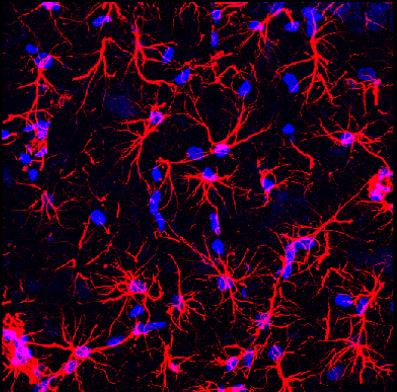 Cover image for research topic "Obesity and Diabetes: Implications for Brain-Immunometabolism"