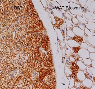 Cover image for research topic "Insights into Brown Adipose Tissue Functions and Browning Phenomenon"