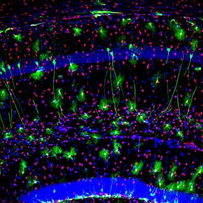 Cover image for research topic "Generation of Neurons and Their Integration in Pre-Existing Circuits in the Postnatal Brain: Signalling in Physiological and Regenerative Contexts"