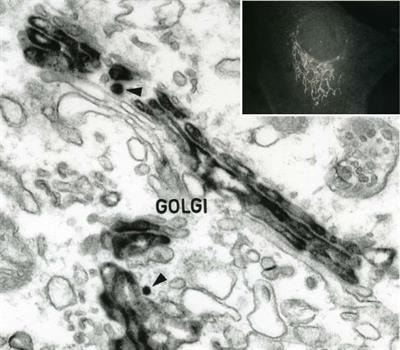 Cover image for research topic "Golgi Dynamics in Physiological and Pathological Conditions"