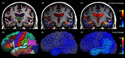 Cover image for research topic "Clinical use of biomarkers for neurodegenerative disorders"