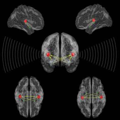 Cover image for research topic "Neuroimaging Approaches to the Study of Tinnitus and Hyperacusis"