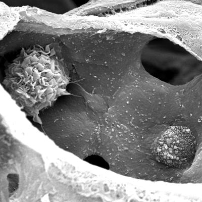 Cover image for research topic "Understanding Lung Acinar Micromechanics in Health and Disease: Linking Quantitative Imaging and Organ Scale Mechanics by Computational Modeling"