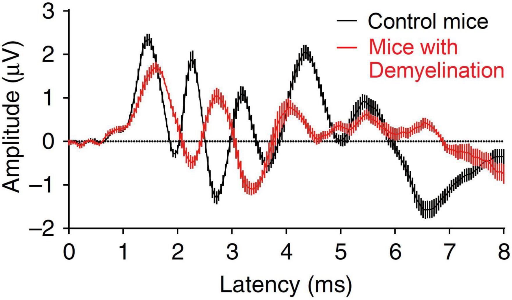 PDF] Investigating the effect of extended high-frequency hearing