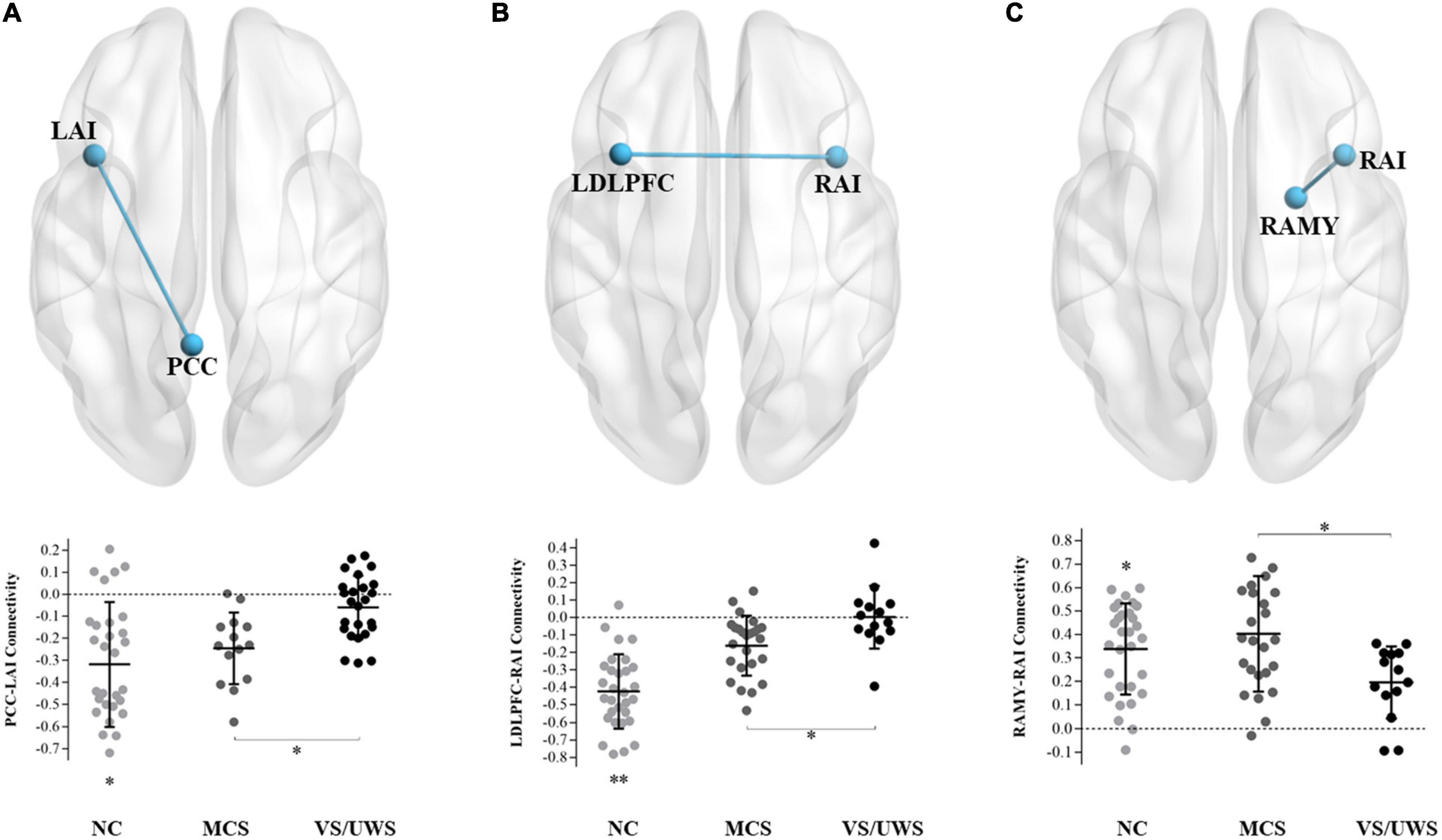 Frontiers Altered Functional Connectivity And Regional Brain Activity
