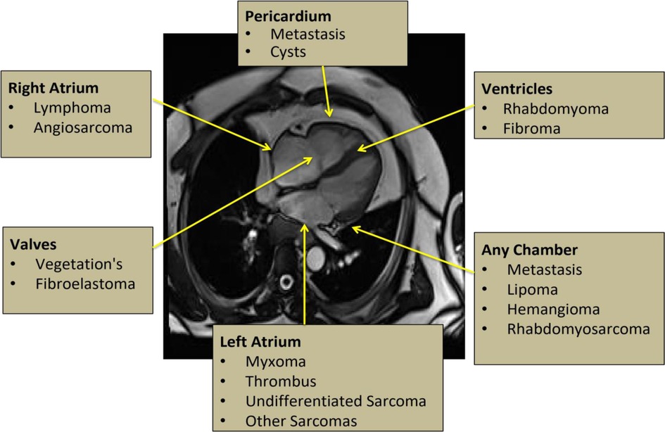 heart histology atrium