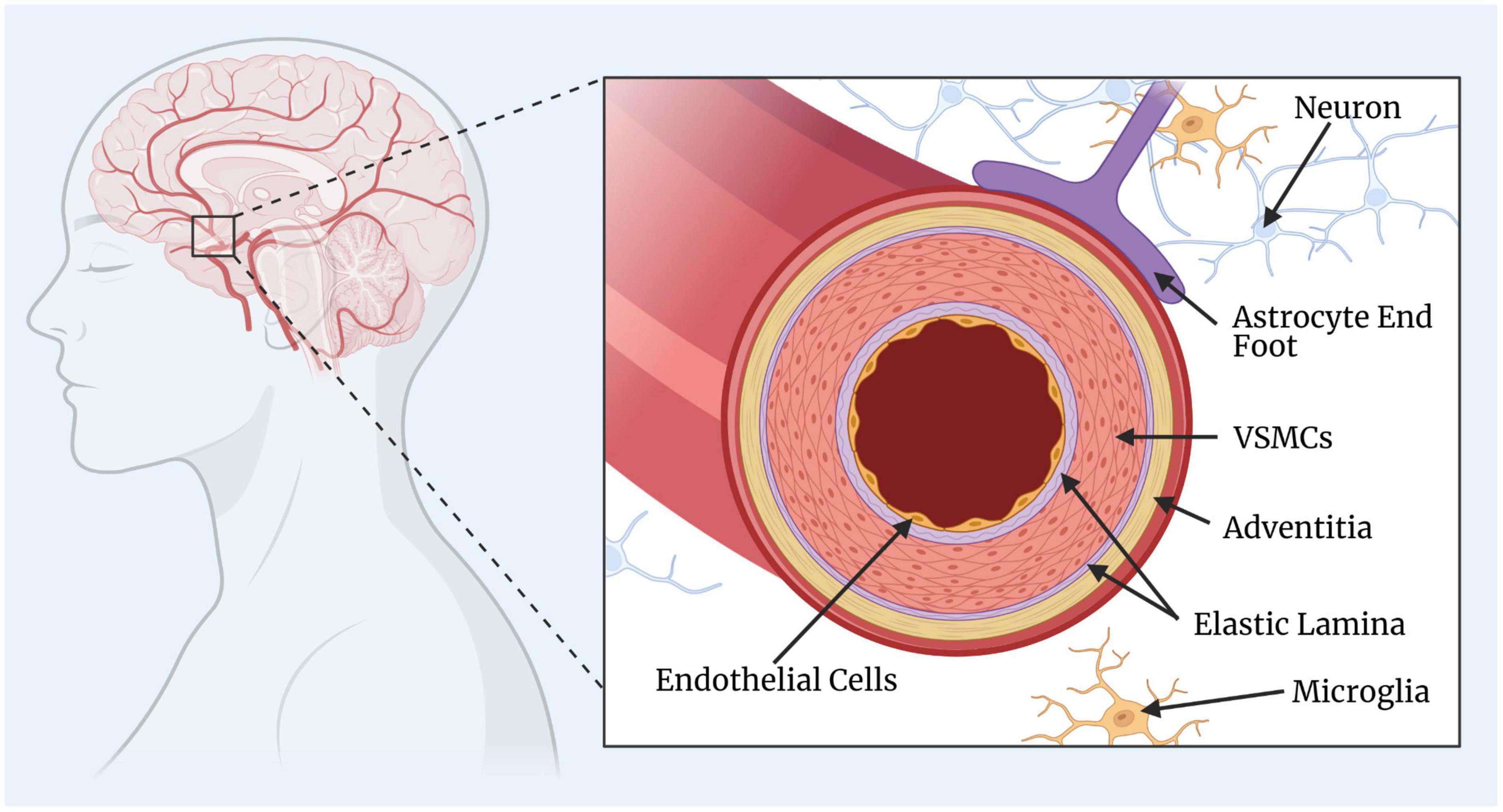 Frontiers Vascular Smooth Muscle Cell Dysfunction In Neurodegeneration