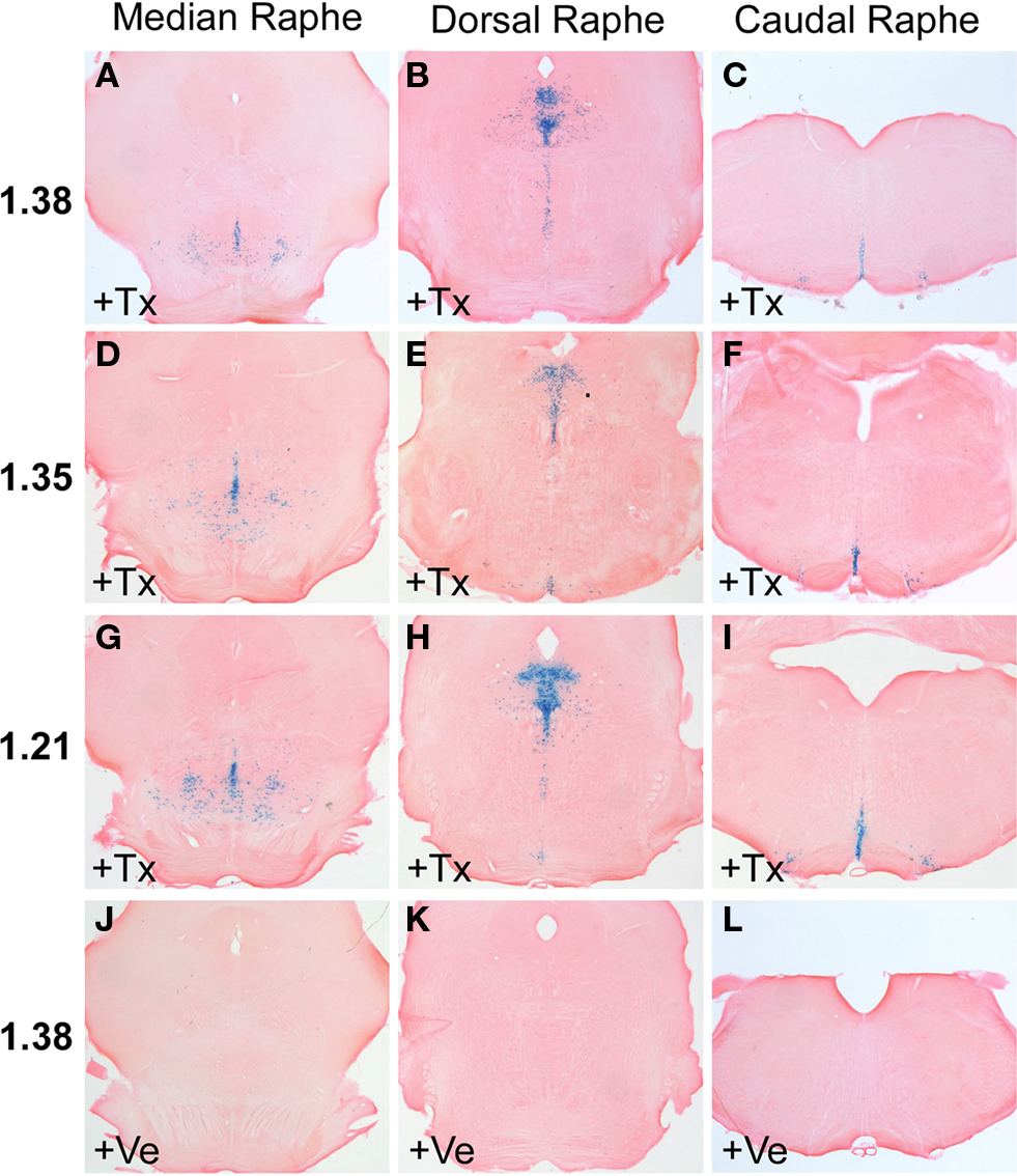 Frontiers | Inducible gene manipulations in serotonergic neurons