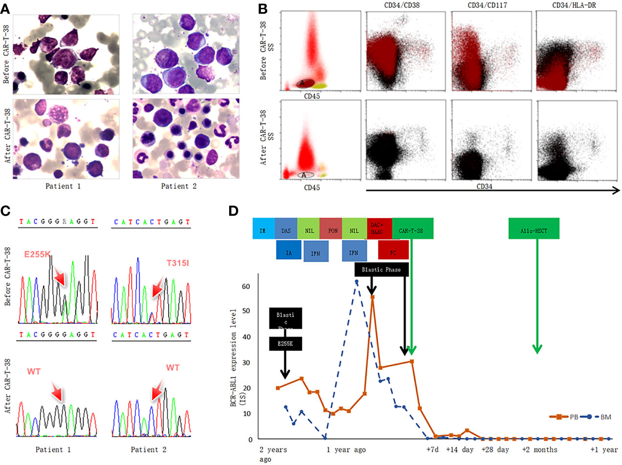 Frontiers | Case Report: CD38-directed CAR-T Cell Therapy: A Novel ...