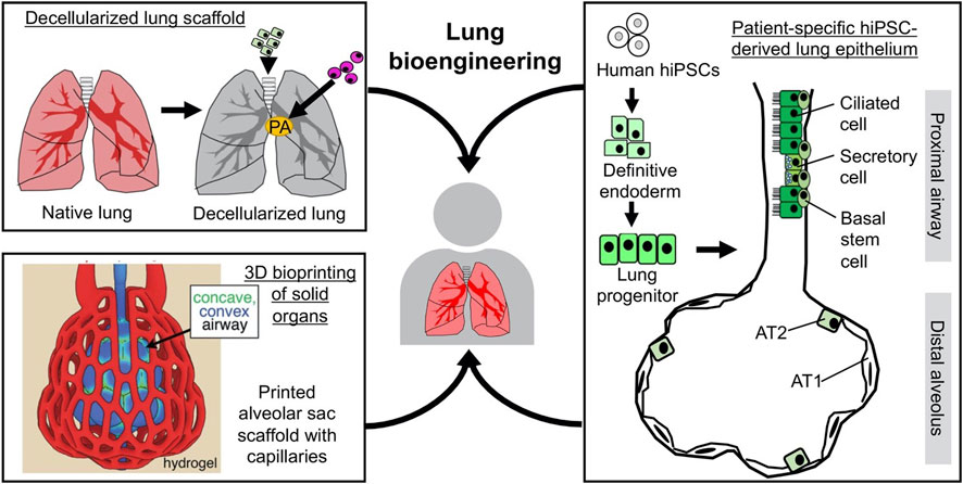 Frontiers  Engineering Tissue-Informed Biomaterials to Advance Pulmonary  Regenerative Medicine
