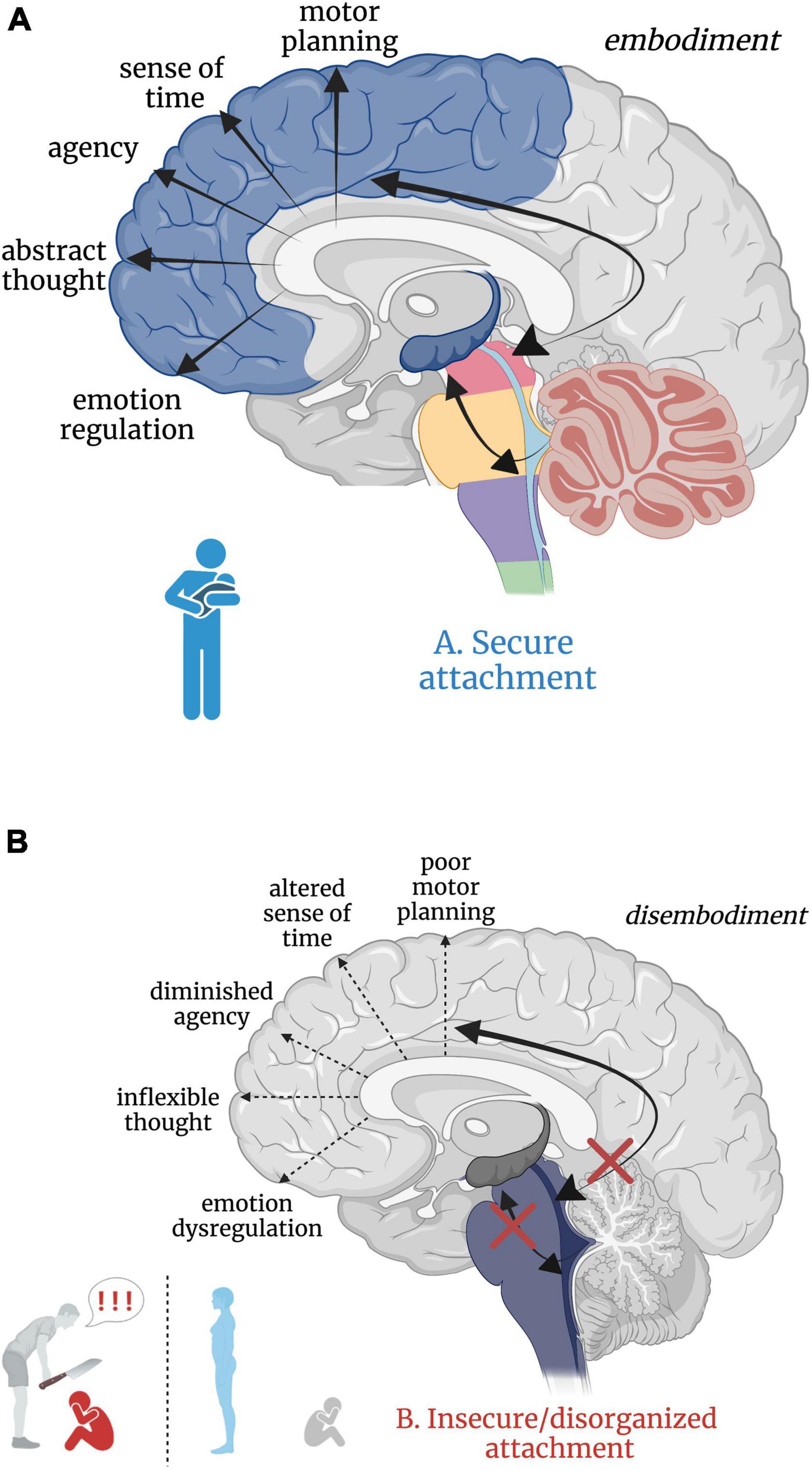 Clear Mind Matters: Exploring 'Brain Fog' and Neurorehab Benefits
