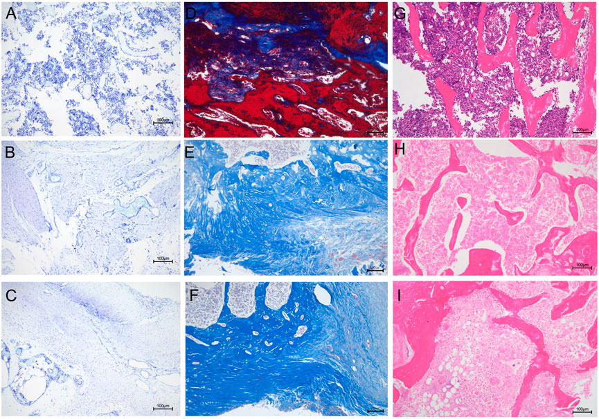 Frontiers  Antibacterial intraosseous implant surface coating that  responds to changes in the bacterial microenvironment