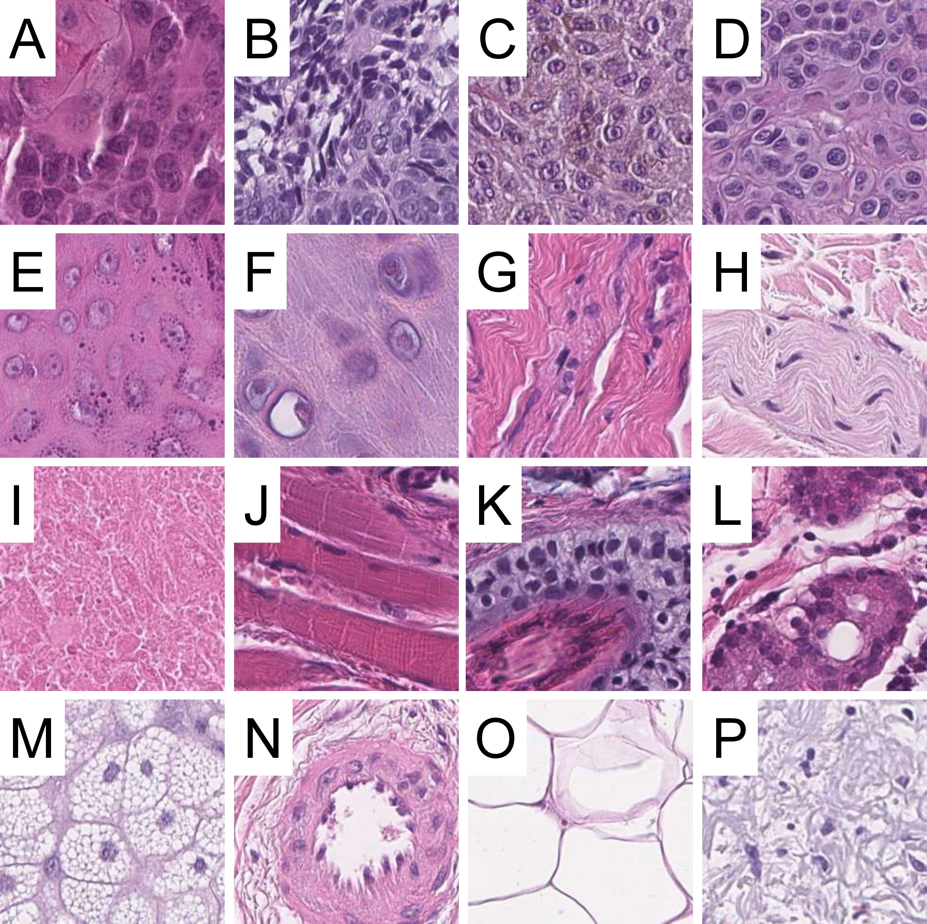 Frontiers Deep Learning For The Detection Of Anatomical Tissue Structures And Neoplasms Of The