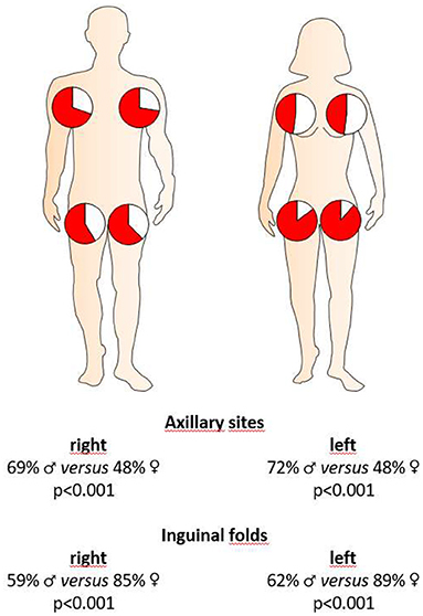 Frontiers Sex Disaggregated Population Analysis In Patients With Hidradenitis Suppurativa 