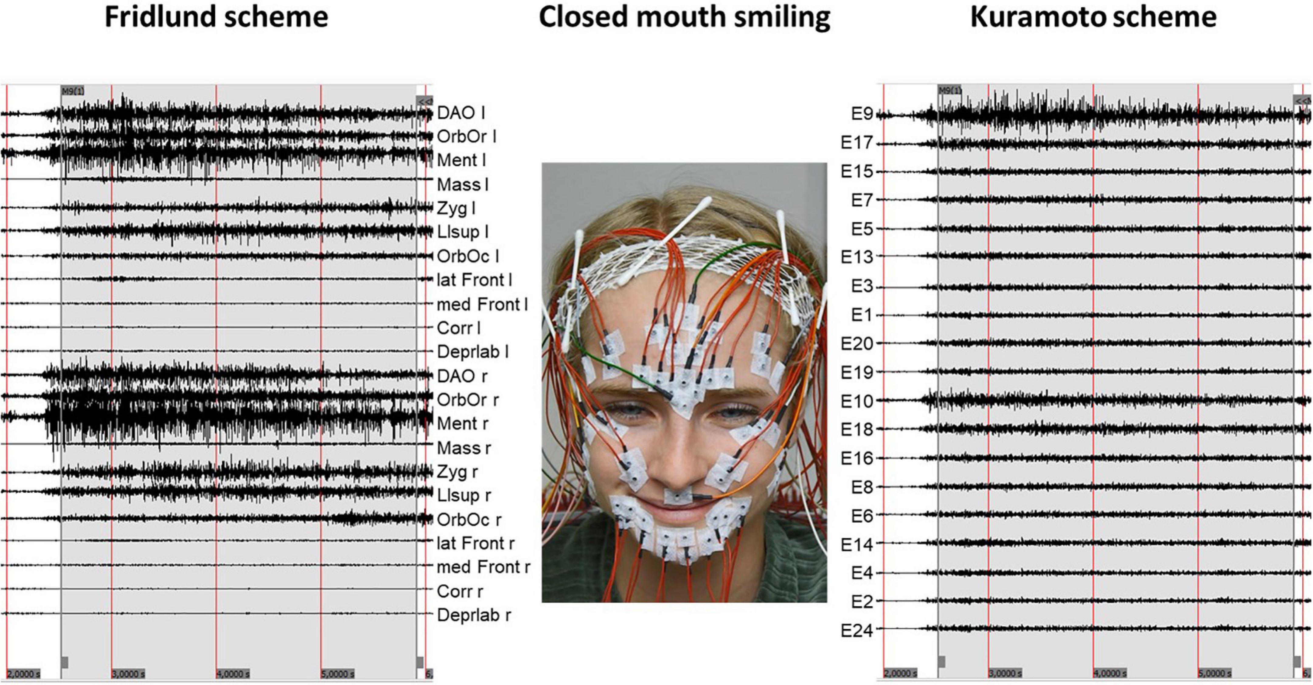 Frontiers  High-resolution surface electromyographic activities