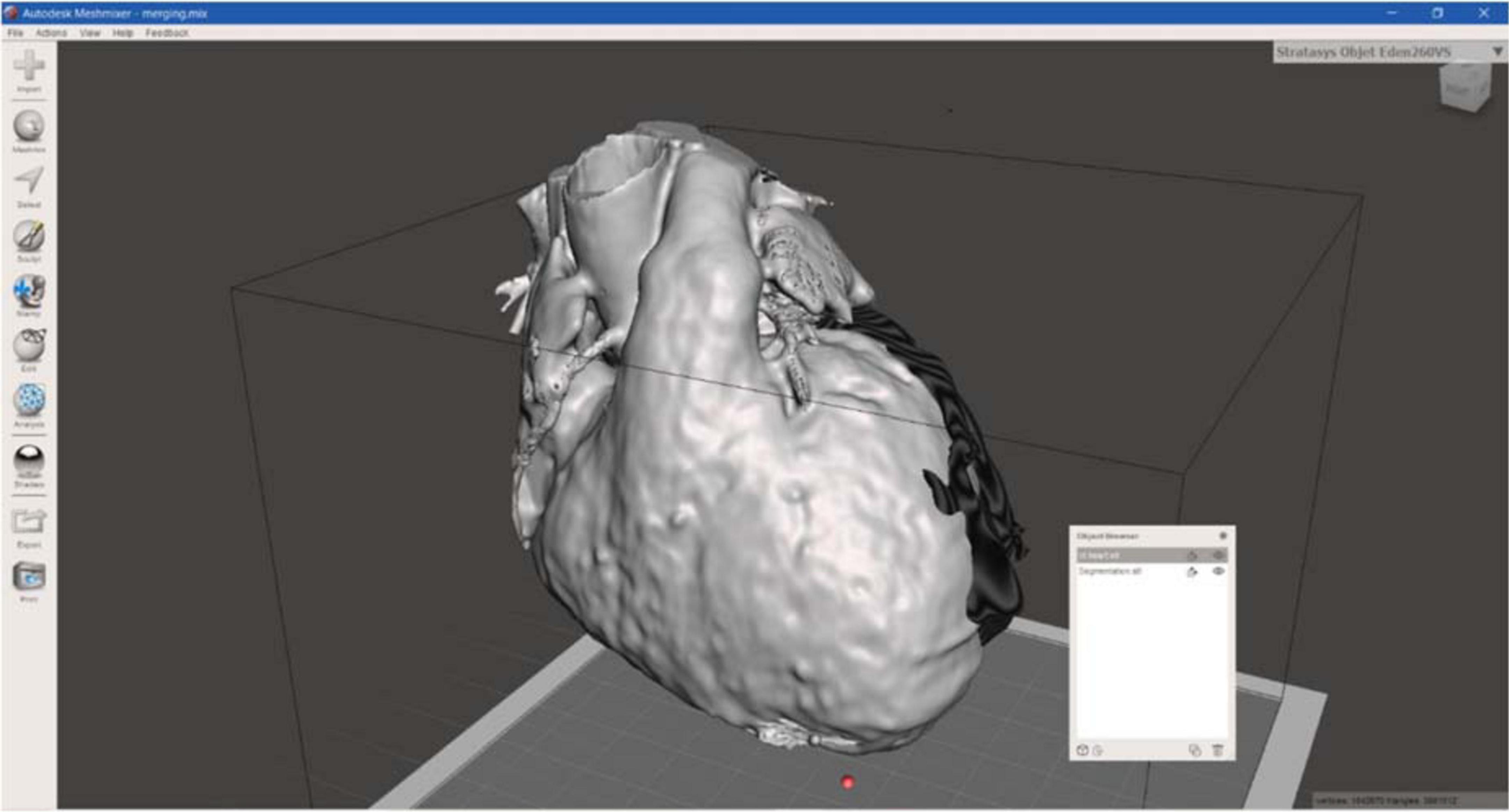 Frontiers | A 3D-printed surgical guide for ischemic scar 