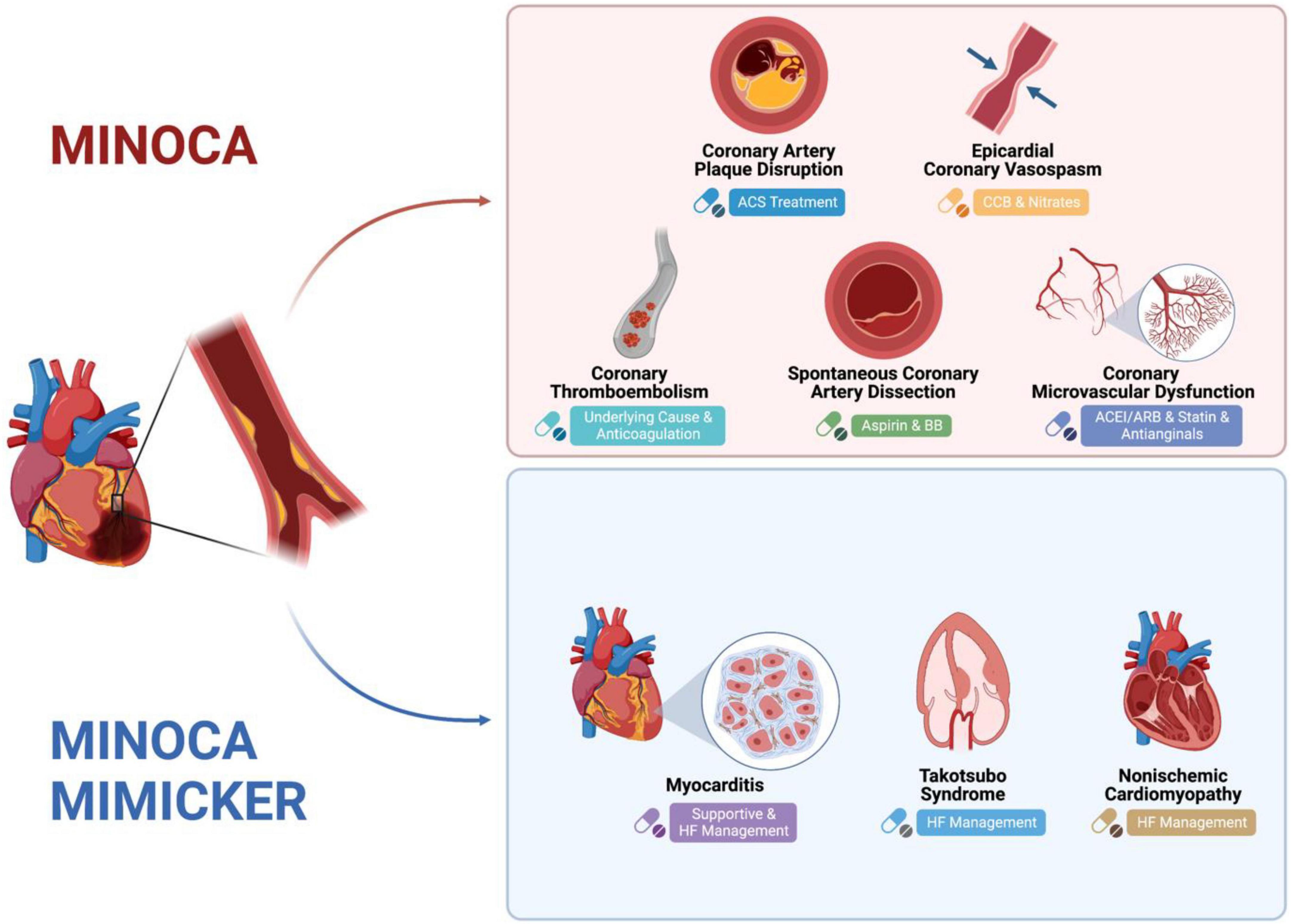 Frontiers Myocardial Infarction With Non obstructive Coronary 