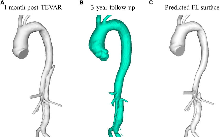 Frontiers | Shear-driven Modelling Of Thrombus Formation In Type B ...