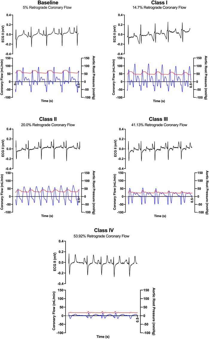 Frontiers | Class of hemorrhagic shock is associated with progressive ...