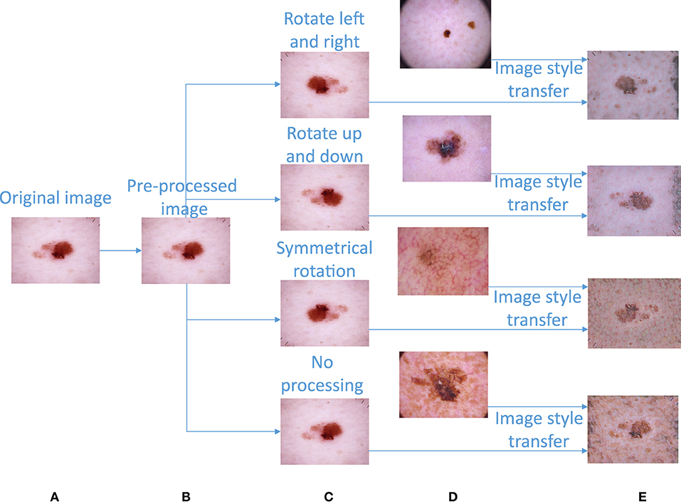 Frontiers | Detection algorithm for pigmented skin disease based on ...