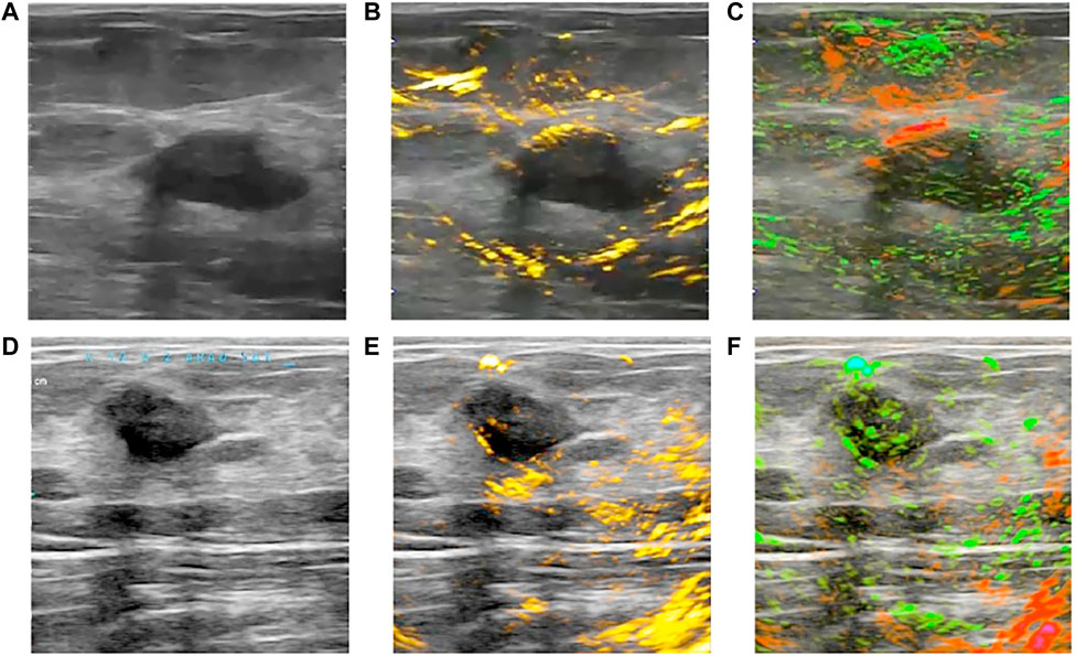 Frontiers  Clinical photoacoustic/ultrasound dual-modal imaging: Current  status and future trends