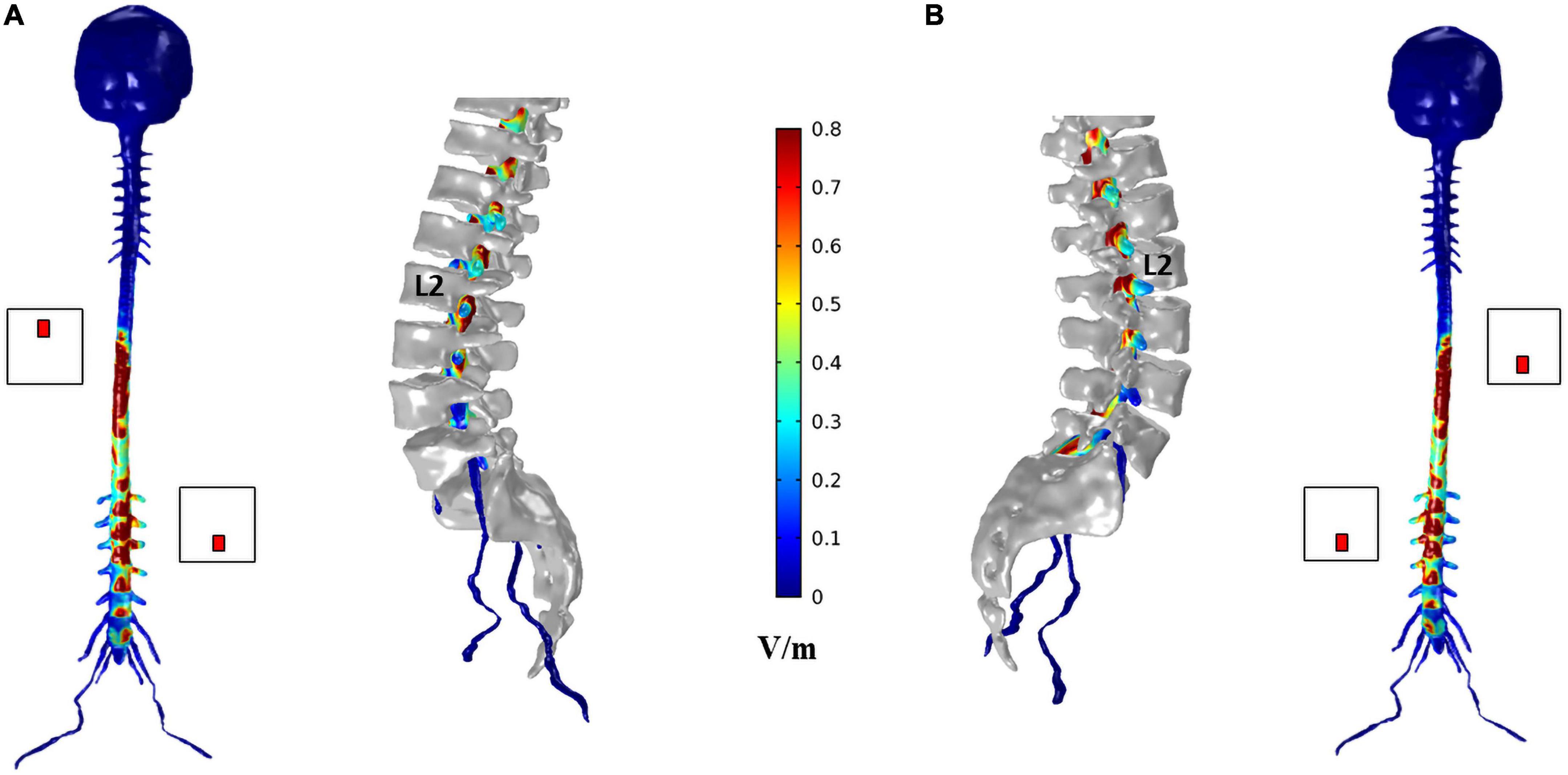 Frontiers | Lumbar trans-spinal direct current stimulation: A