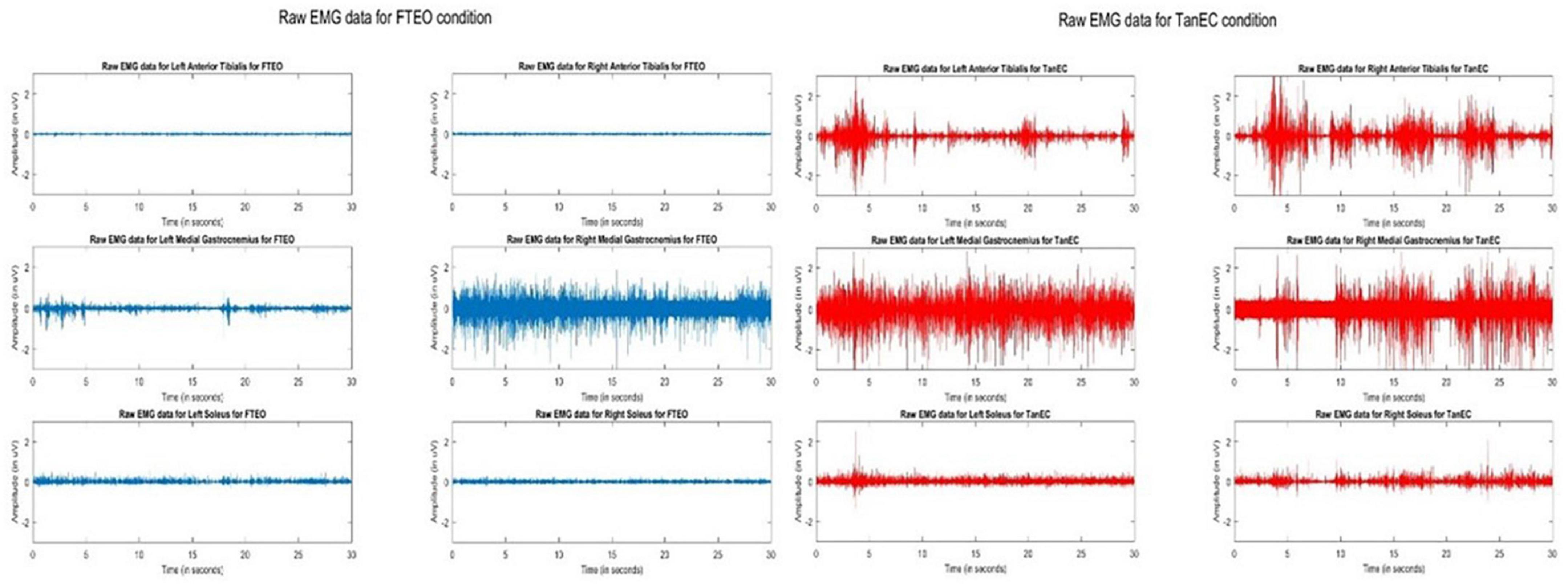 PDF) Specificity of surface EMG recordings for gastrocnemius during upright  standing