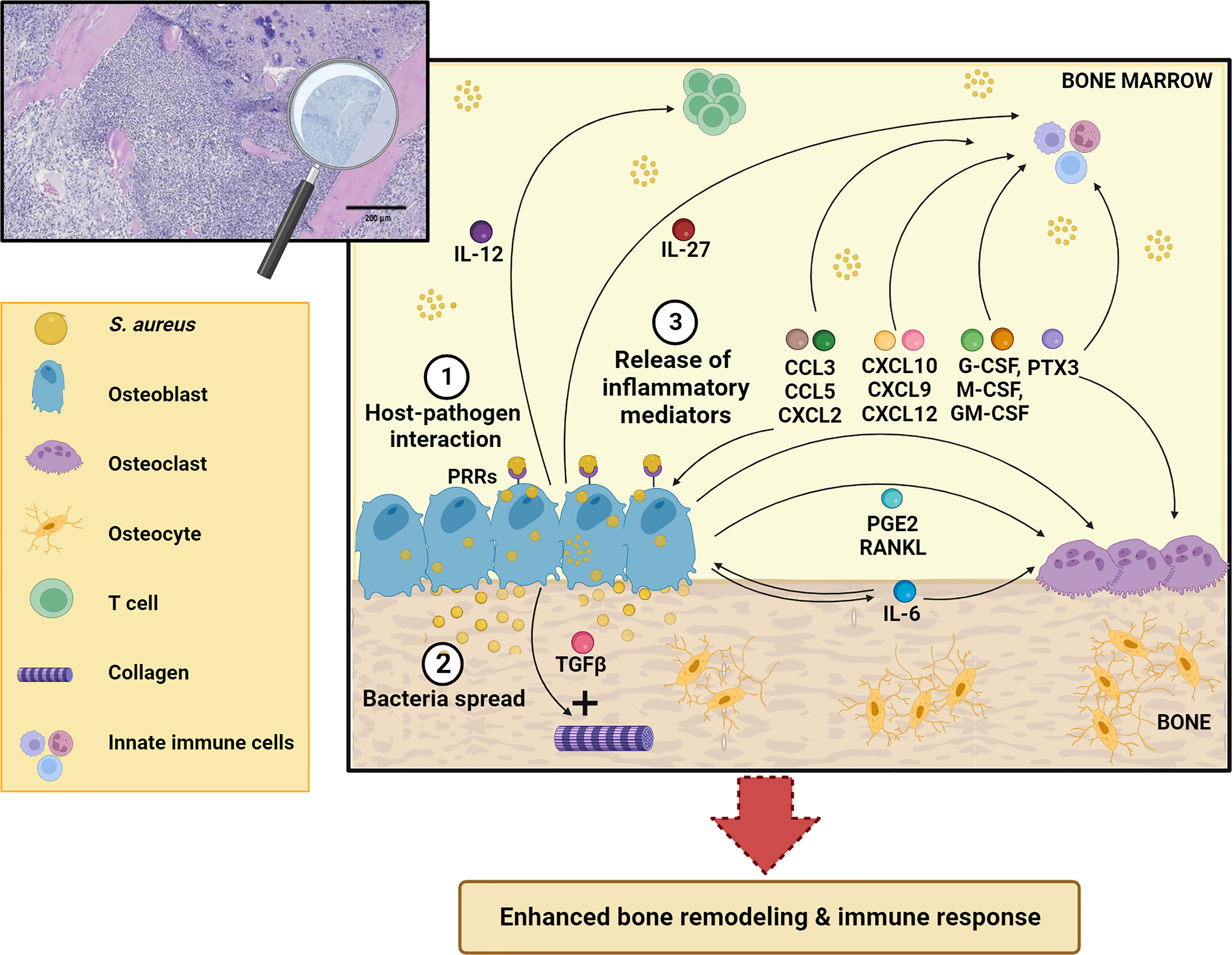 Frontiers  Staphylococcus aureus Cell Wall Biosynthesis Modulates Bone  Invasion and Osteomyelitis Pathogenesis