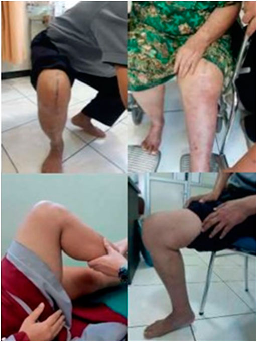 High knee flexion in different cultures