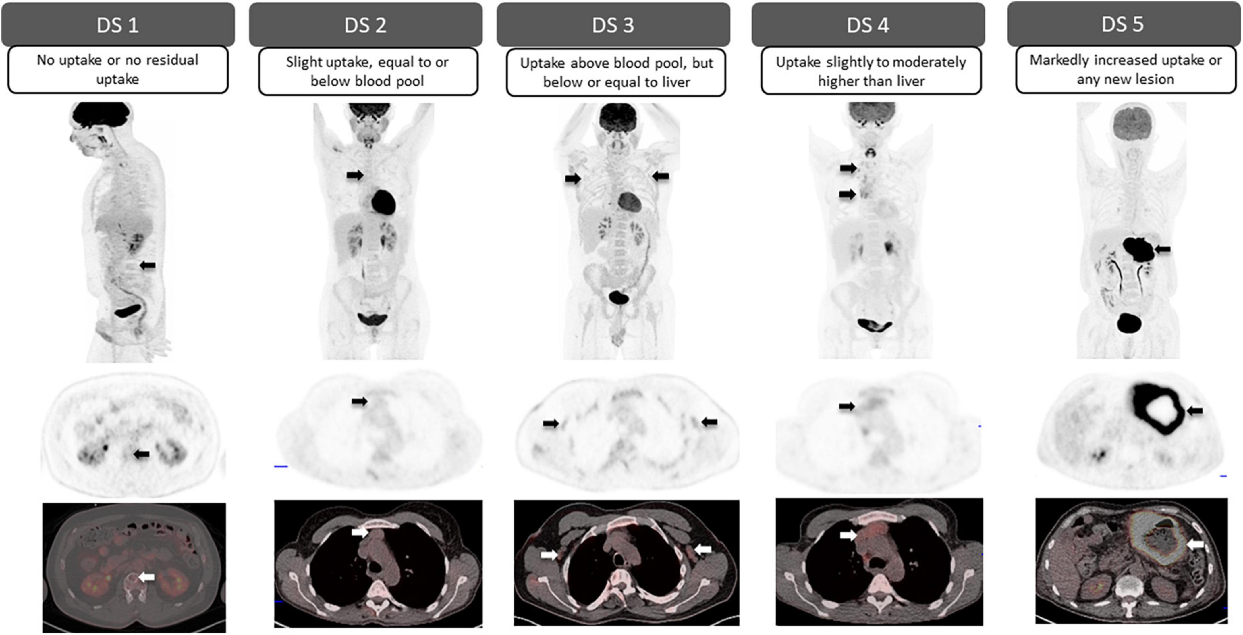 frontiers-standardized-classification-schemes-in-reporting-oncologic