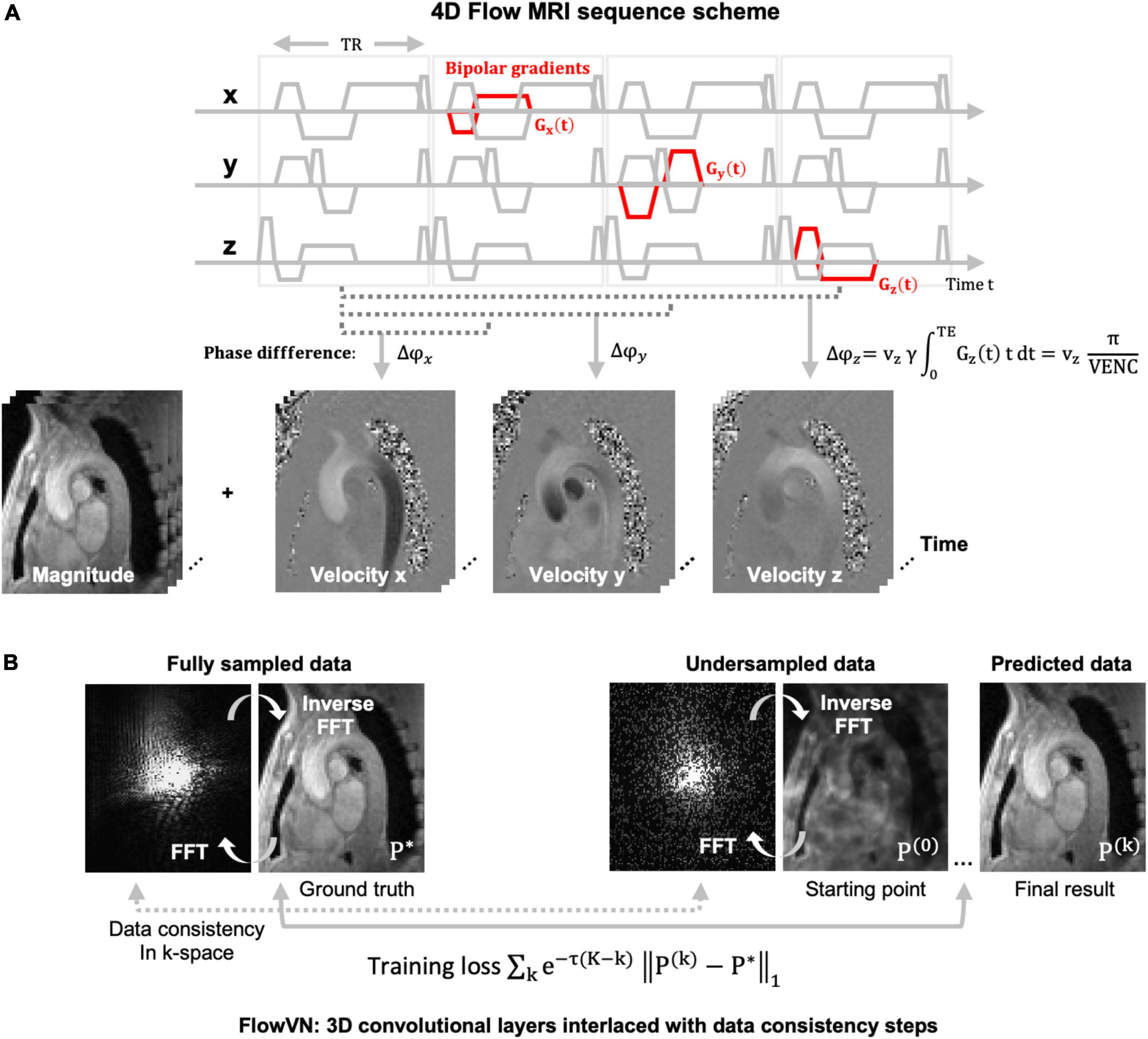 Computational evaluation of an extra-aortic elastic-wrap applied