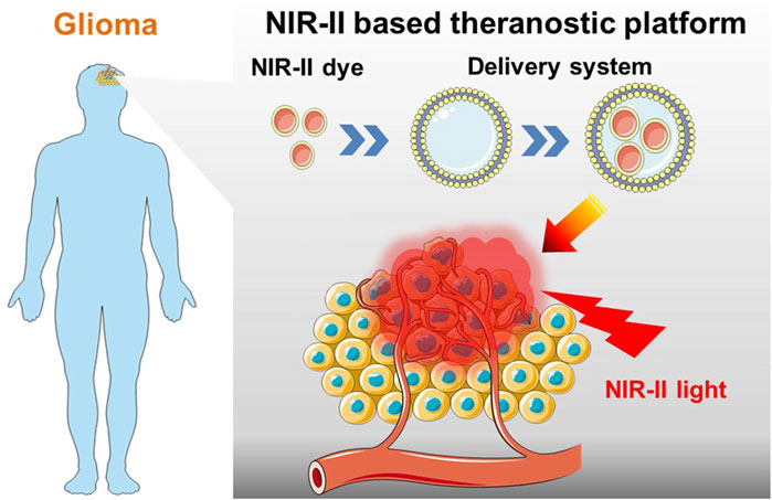 Frontiers Recent Advances In Nir Ii Fluorescence Based Theranostic Approaches For Glioma
