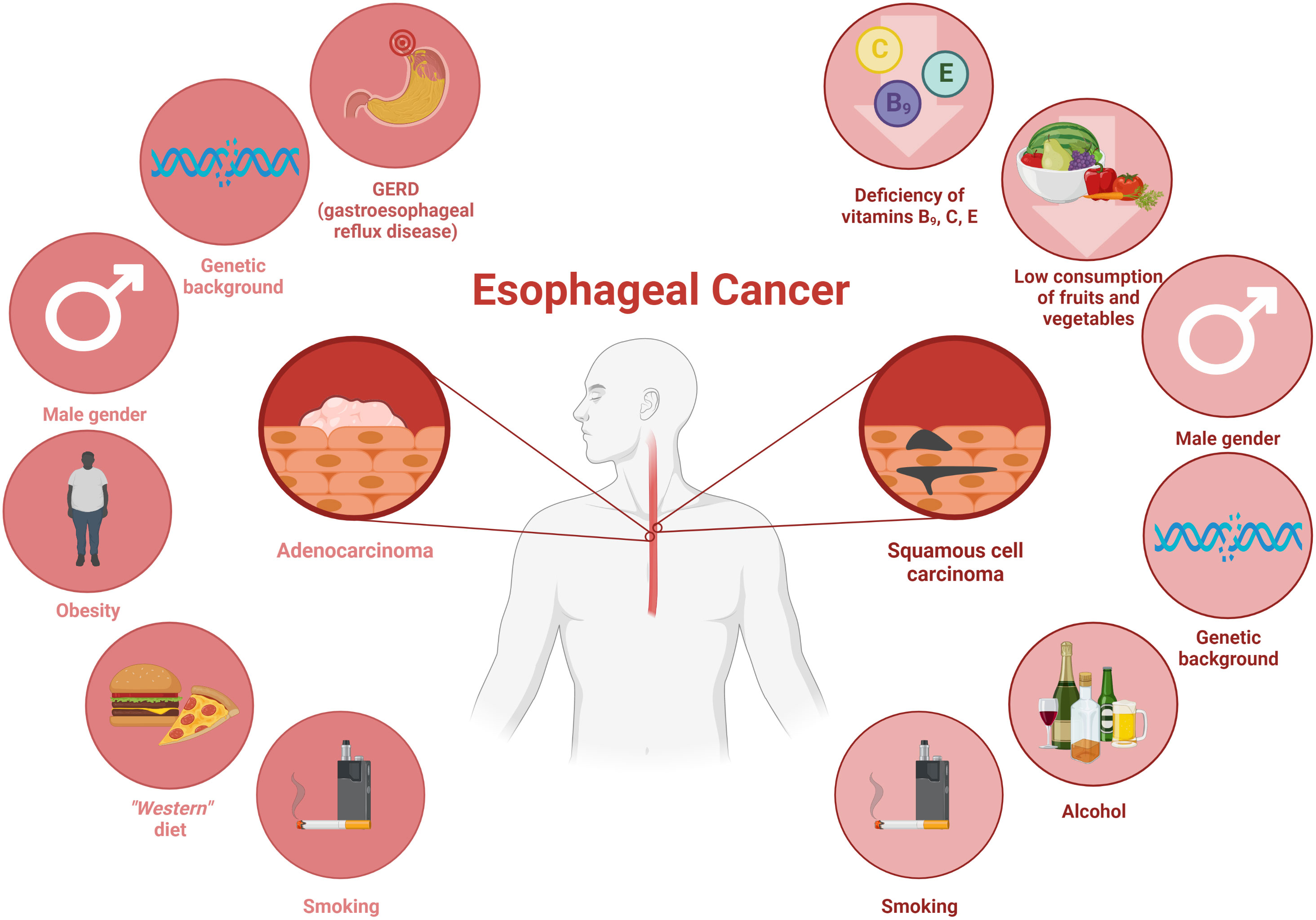 Frontiers Esophageal Cancer And Bacterial Part Of Gut Microbiota A 