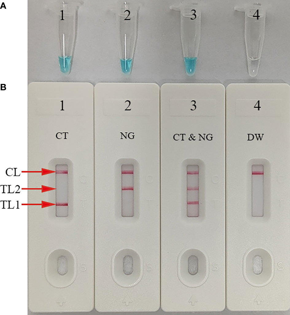 Frontiers Visual And Rapid Identification Of Chlamydia Trachomatis And Neisseria Gonorrhoeae 6733