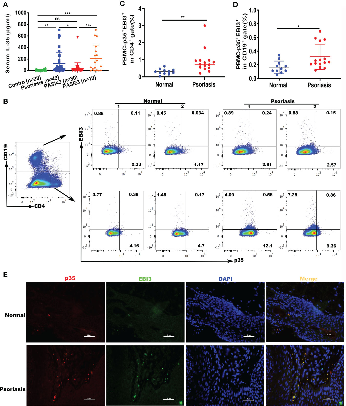 What A Paradoxical TNF Signaling Pathway-Based on Different  Receptors-CUSABIO