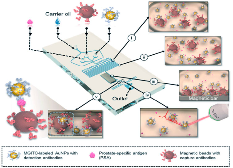 Frontiers  Recent progress of microfluidic chips in immunoassay