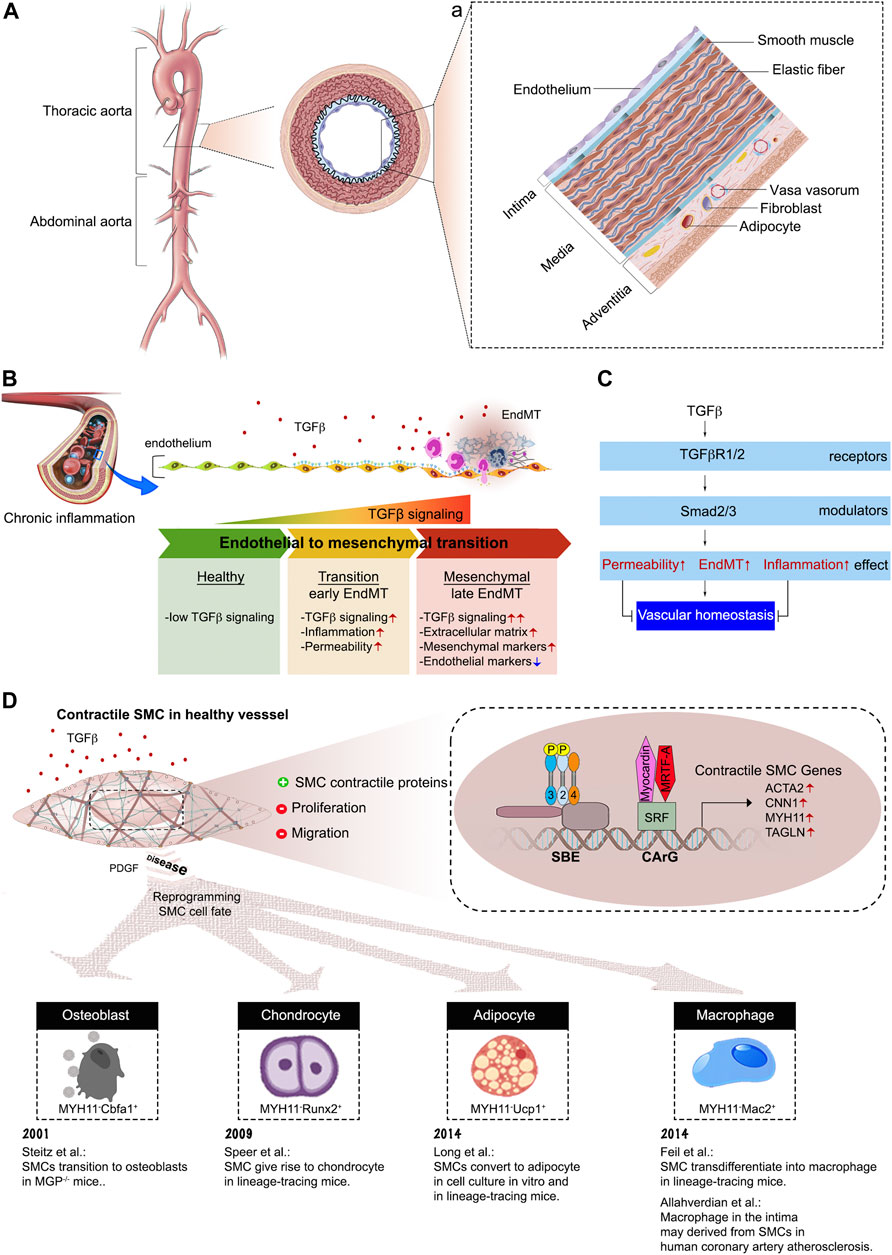 Molecular Mechanisms in Genetic Aortopathy–Signaling Pathways and Potential  Interventions