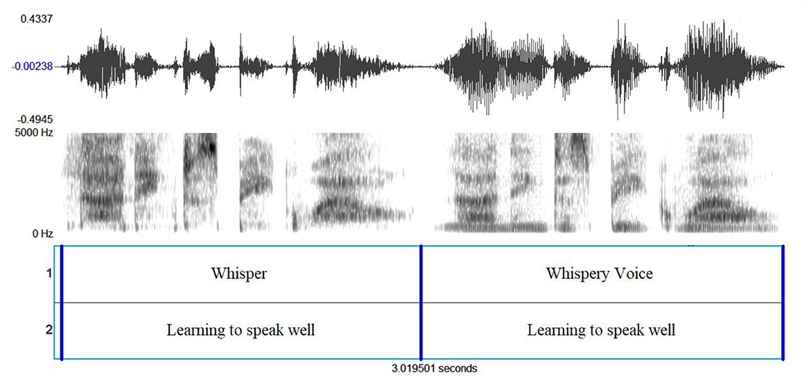 SciELO - Brasil - Multidimensional voice assessment: the immediate effects  of Lax Vox<sup>®</sup> in singers with voice complaints Multidimensional  voice assessment: the immediate effects of Lax Vox<sup>®</sup> in singers  with voice complaints