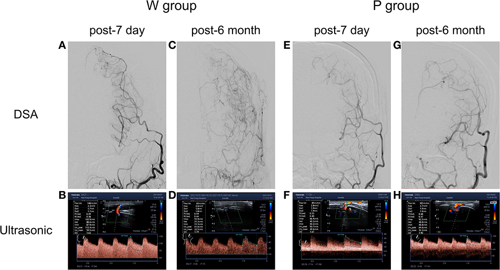 Frontiers | Ultrasonic hemodynamic changes of superficial